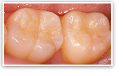 �R���|�W�b�g���W���C��