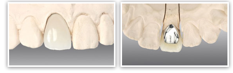 �d�����W���O����