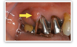 �������i�������̒��̍��j�Ɍ���������