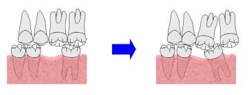 �������u