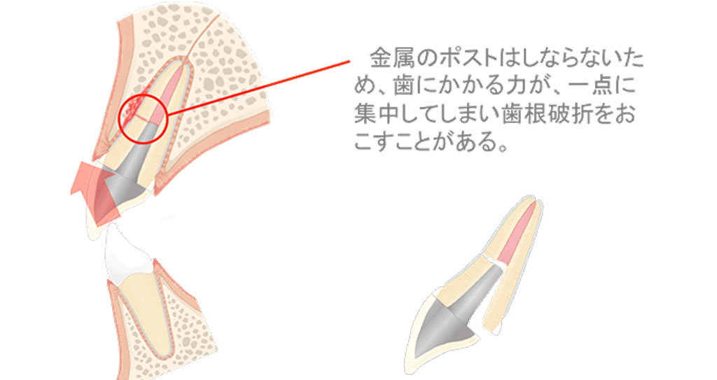 �|�X�g�R�A�j��