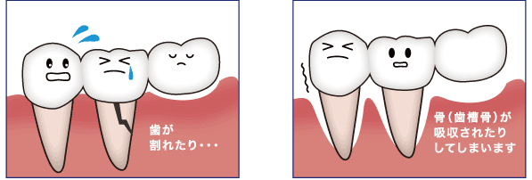 �����u���b�W���S