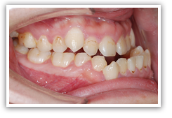 ���{�O��