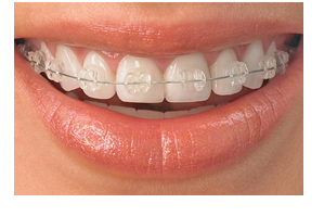 ���l����